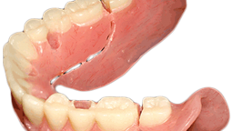 AvaDent_conversion_denture