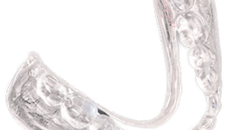 AvaDent_implant_record_device