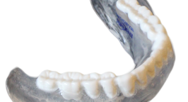 AvaDent_scanning_guide_denture