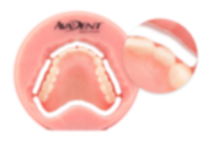 AvaDent_bio-300x198_2