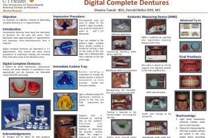 Digital Complete Dentures