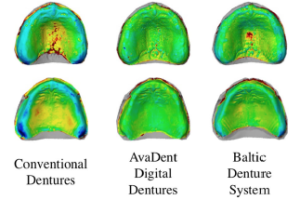 CAD:CAM produces dentures IMAGE