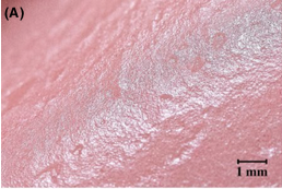 Influence of CADCAM IMAGE