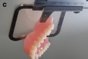 MILLED REMOVABLE Image