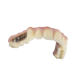 denture with bar