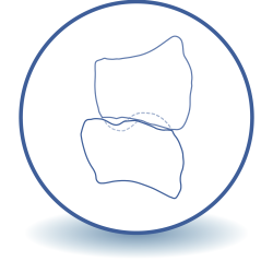 conventionele-statische-occlusie