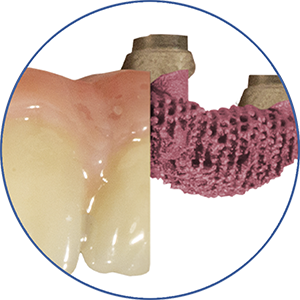 eigenschap-protheses_PMMA-honingraad