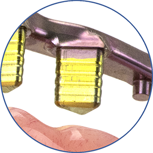 eigenschap-protheses_accelerset-patent