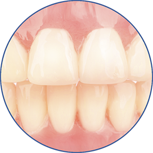 eigenschap-protheses_overname-dentitie