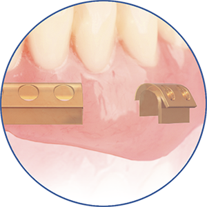 eigenschap-protheses_ruiters