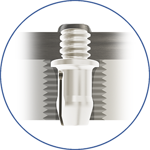 eigenschap-protheses_snap-pin-screw-in-place