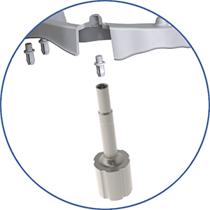 eigenschap-protheses_snap-pin-screw