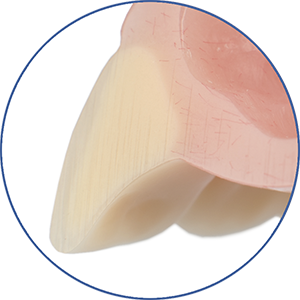 eigenschap-protheses_xcl